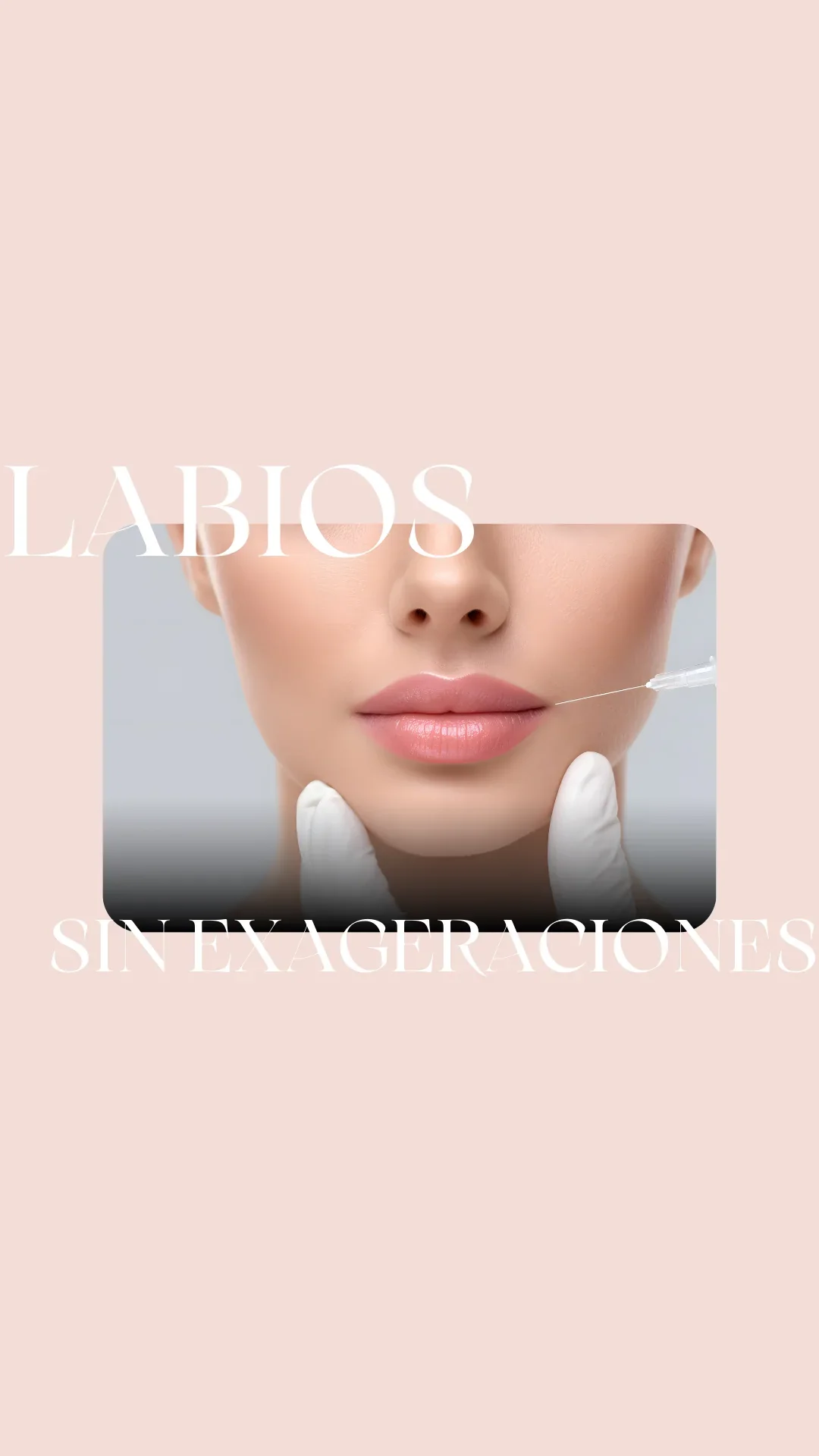 Labios